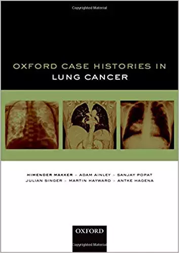 Oxford Case Histories in Lung Cancer - eBook