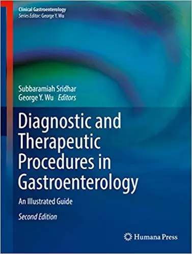 Diagnostic and Therapeutic Procedures in Gastroenterology: An Illustrated Guide (2nd Edition) - eBook