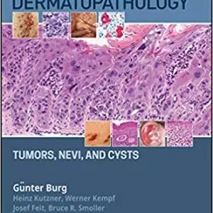 Atlas of Dermatopathology: Tumors, Nevi, and Cysts - eBook