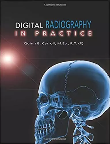 Digital Radiography in Practice - eBook