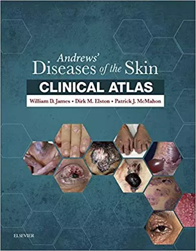 Andrews' Diseases of the Skin Clinical Atlas: Expert Consult Har/Psc Edition - eBooks