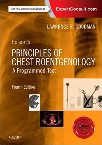 Felson's Principles of Chest Roentgenology (4th Edition) - eBook