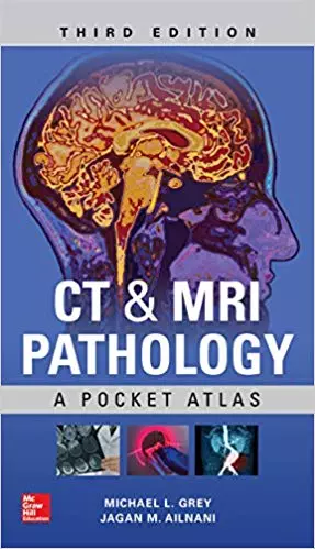 CT & MRI Pathology: A Pocket Atlas (3rd Edition) - eBook