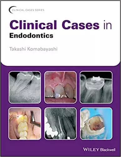 Clinical Cases in Endodontics - eBook