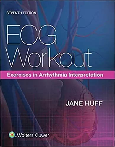 ECG Workout: Exercises in Arrhythmia Interpretation (7th Edition)- eBook