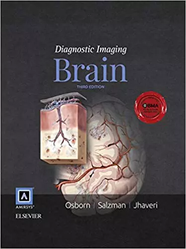 Diagnostic Imaging: Brain (3rd Edition) - eBook