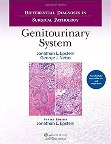 Differential Diagnoses in Surgical Pathology: Genitourinary System - eBook