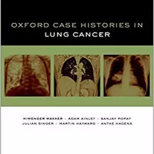 Oxford Case Histories in Lung Cancer - eBook