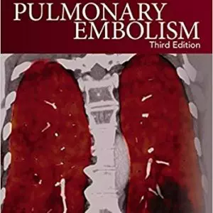 Pulmonary Embolism (3rd Edition) - eBook