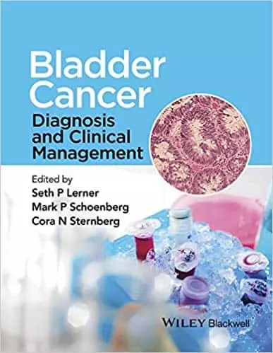 Bladder Cancer: Diagnosis and Clinical Management - eBook