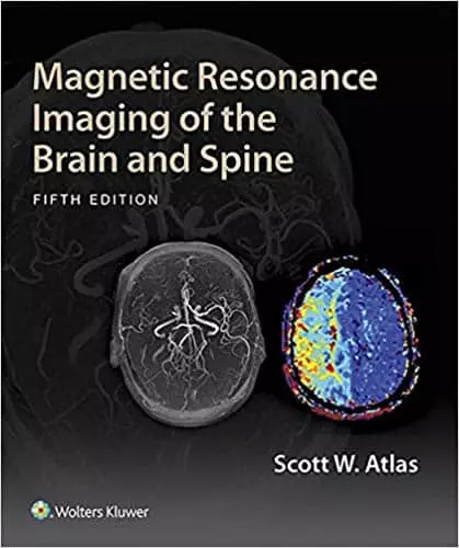 Magnetic Resonance Imaging of the Brain and Spine (5th Edition) - eBook