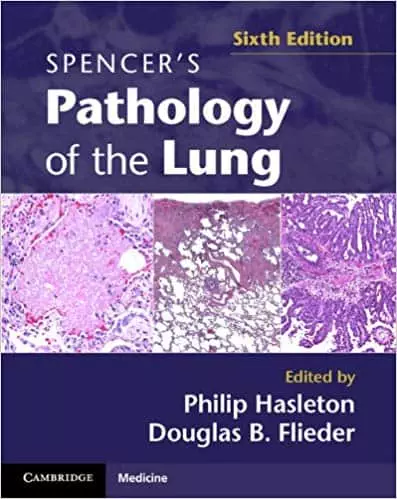 Spencer's Pathology of the Lung 2 Part Set (6th Edition) - eBook