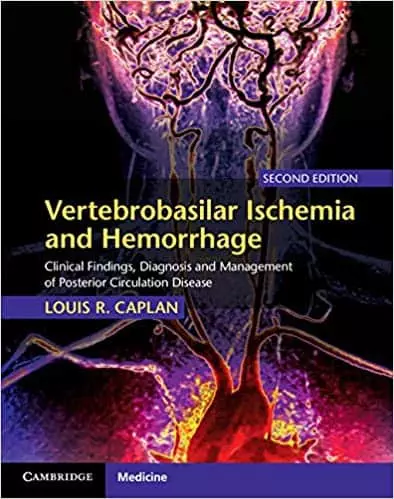 Vertebrobasilar Ischemia and Hemorrhage: Clinical Findings, Diagnosis and Management of Posterior Circulation Disease (2nd Edition) - eBook