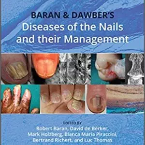 Baran and Dawber's Diseases of the Nails and their Management (5th Edition) - eBook