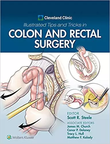 Cleveland Clinic Illustrated Tips and Tricks in Colon and Rectal Surgery - eBook