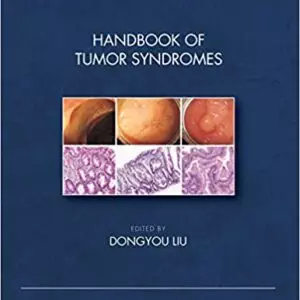 Handbook of Tumor Syndromes - eBook