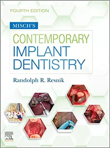 Misch's Contemporary Implant Dentistry E-Book (4th Edition) - eBook