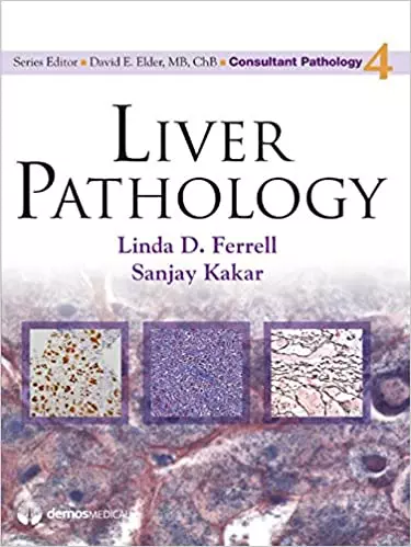 Liver Pathology (Consultant Pathology Book 4) - eBook