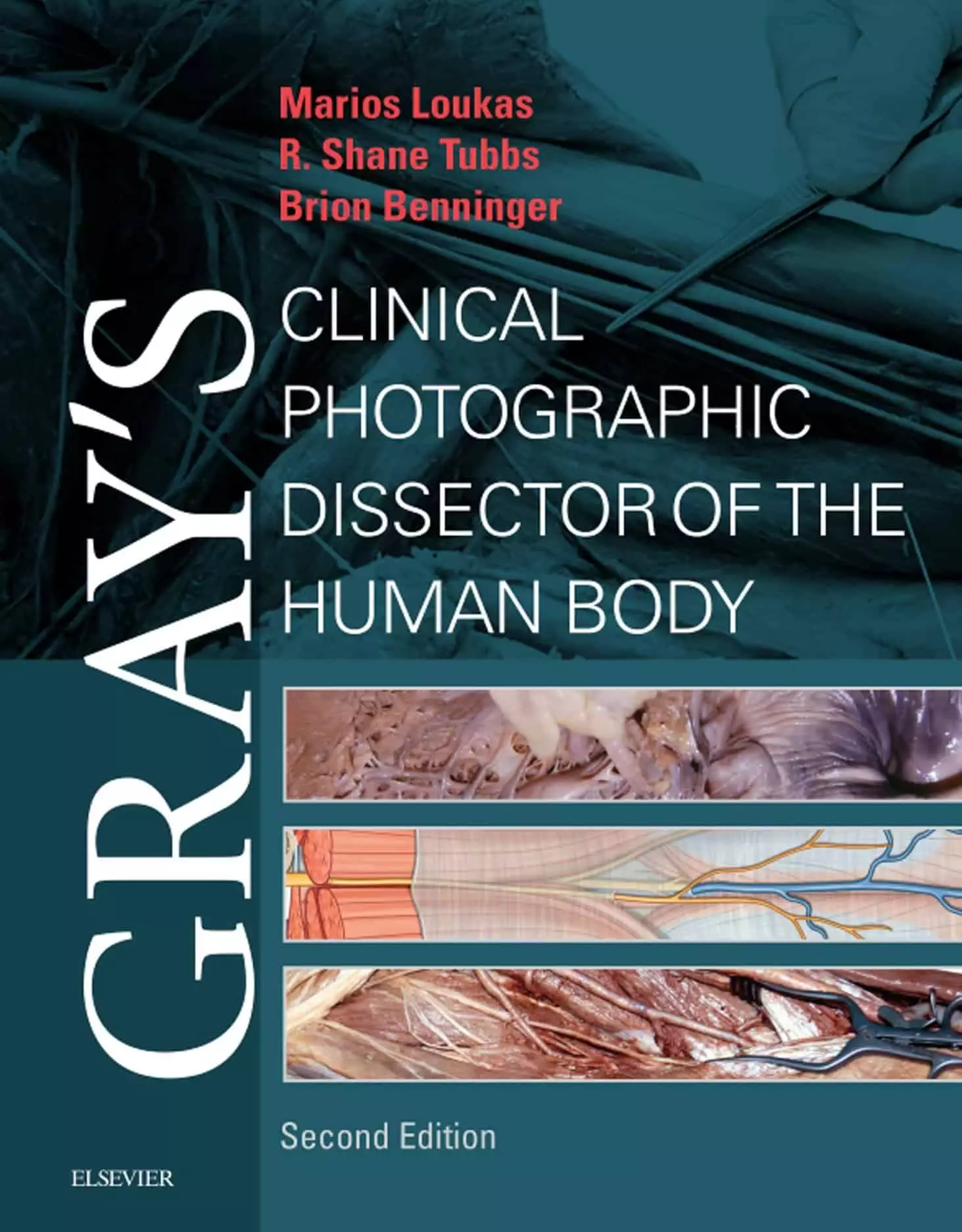 Gray's Clinical Photographic Dissector of the Human Body (2nd Edition) - eBook