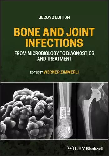 Bone and Joint Infections: From Microbiology to Diagnostics and Treatment (2nd Edition) - eBook