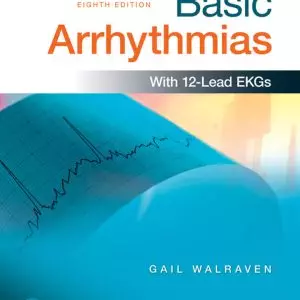 Basic Arrhythmias (8th Edition) - eBook