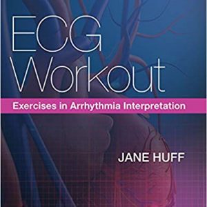 ECG Workout: Exercises in Arrhythmia Interpretation (7th Edition)- eBook