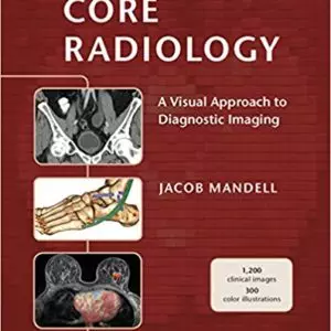 Core Radiology: A Visual Approach to Diagnostic Imaging (1st Edition) - eBooks