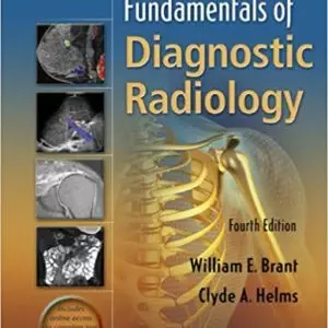 Fundamentals of Diagnostic Radiology 4th Edition